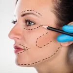 Trends in cosmetic surgery