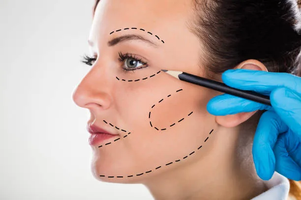 Trends in cosmetic surgery