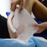 How To Freeze Fat With CoolSculpting UK