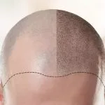 Best Affordable Plastic Surgery; Enhance Your Appearance
