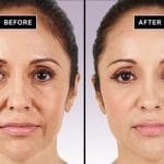 Wrinkles are gone!